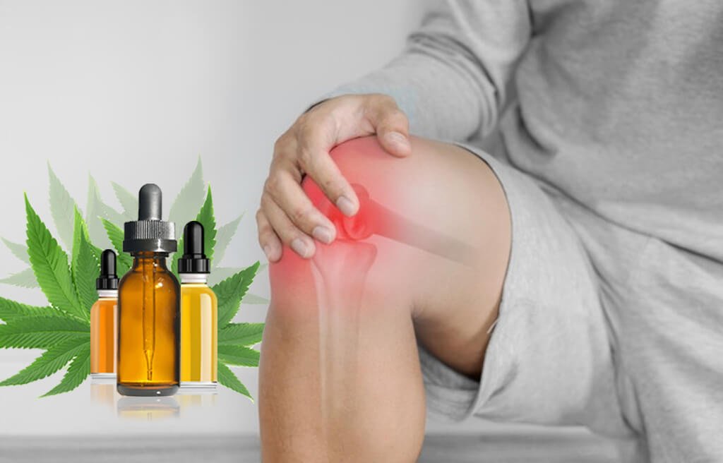 Cannabis (CBD) Benefits in Arthritis, Constipation and Gout